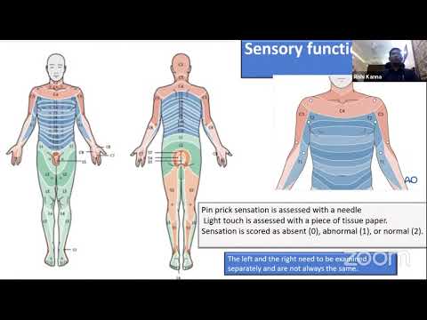 Thoraco Lumbar Fractures
