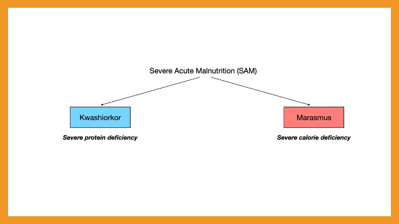 Marasmus vs. Kwashiorkor (Severe Acute Malnutrition)