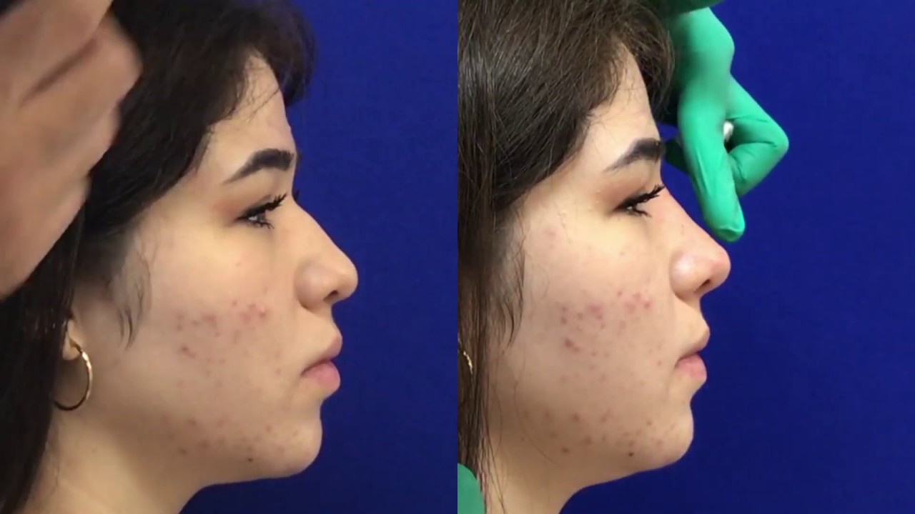 José Cortés Arreguin-32