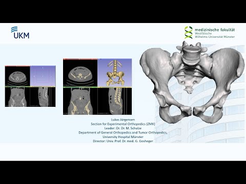 3D Slicer Tutorial: Pelvic Bone Segmentation