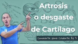 Artrosis: Conoce tu cuerpo para proteger tus articulaciones