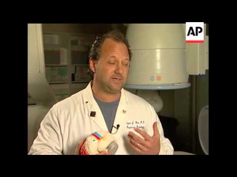 Sen. Tim Johnson has been conscious at times since his emergency brain surgery last week, his spokes