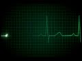 Heart beat going to death die | ecg | doctor | heart beat monitor