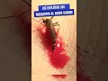 Los mosquitos explotan bebiendo sangre