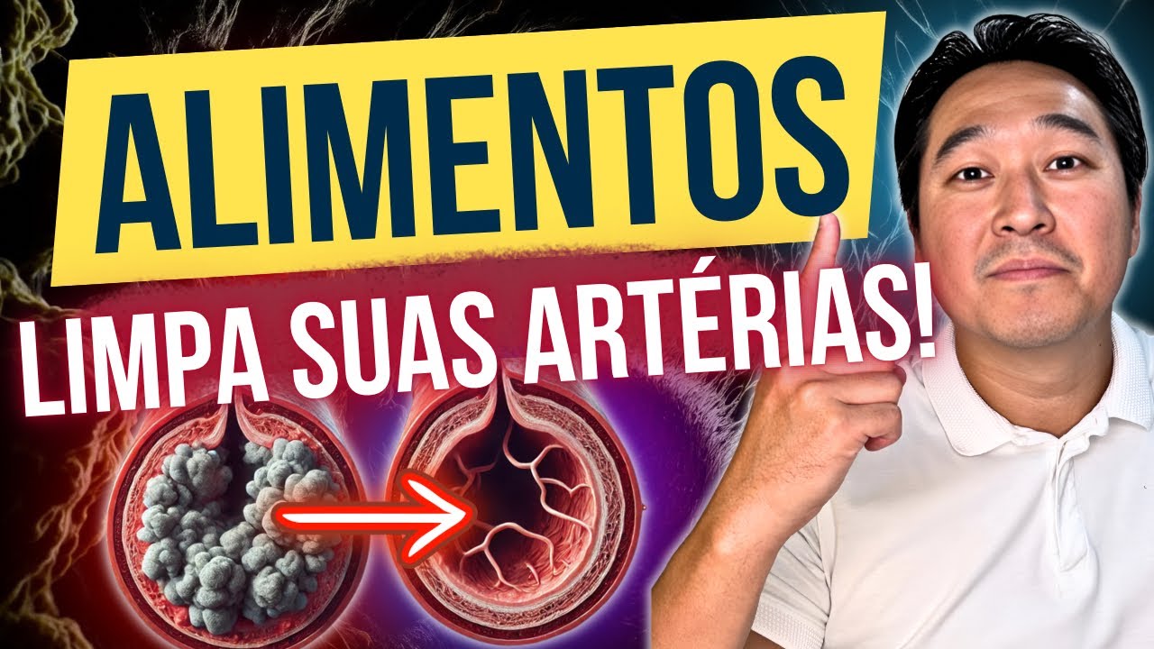 7 ALIMENTOS QUE LIMPAM AS SUAS ARTÉRIAS!