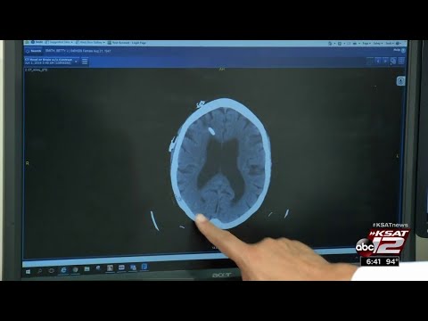 Video: NPH: Reversing Brain Disorder