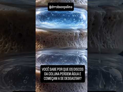 Robson Prudêncio Silva Lima-216
