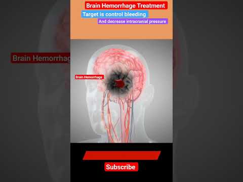 Brain Hemorrhage Treatment l Mannitol l Craniotomy #stroke  #shorts