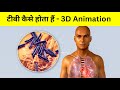 ट्यूबरकुलोसिस TB कैसे होता हैं Tuberculosis Etiology