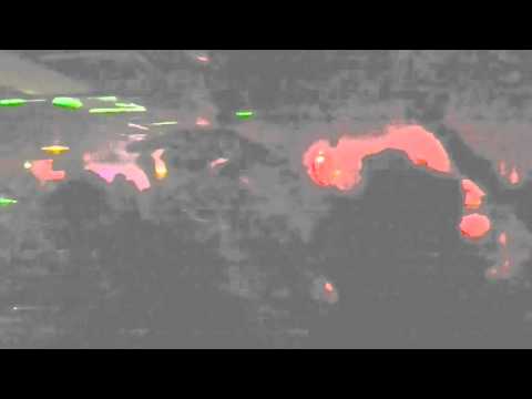 LIVE ART IS ANAL (FIST OF FURY & ARMAGUET NAD)