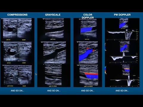 Introduction to Venous Insufficiency Exams