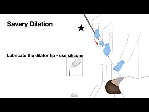 HCC 1475-38d-Bougie Dilator With Wire