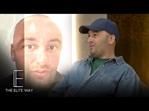 “Te une botoxi ka marre kahje te kundert” – Samed Feka tregon se si vendosi te nderhyje ne fytyren e