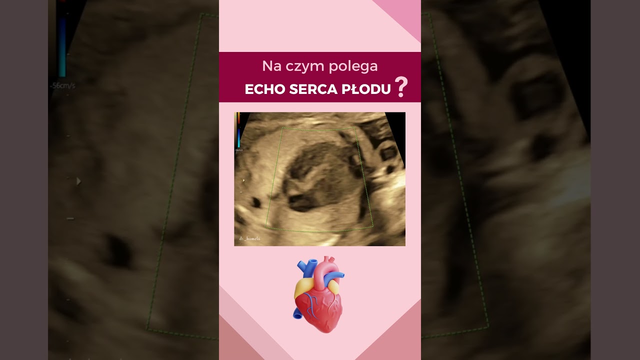 Anita Hamela-Olkowska-12