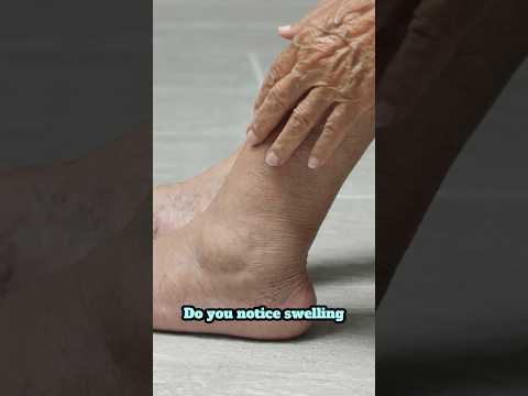 Signs that your lungs are struggling part 1 #lungs #copd #breathing