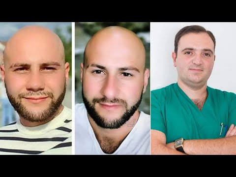 #VLOG/ ՔԹԻ ՊԼԱՍՏԻԿ ՎԻՐԱՀԱՏՈՒԹՅՈՒՆ / Բժիշկ Գոռ Ամիրբեկյան / #Argamblog #Rhinoplasty