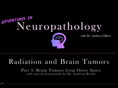 Radiation and Brain Tumors Part 3: Brain Tumors and Outer Space, featuring Dr  Sandeep Burma