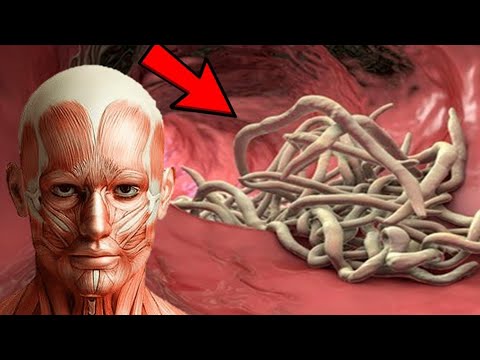7 WARNZEICHEN, dass dein Körper voller Parasiten ist💥(Wichtig)🤯