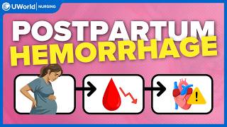 Master Postpartum Hemorrhage for NCLEX®! (Live Concept Map)