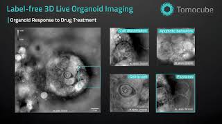 Organoid Drug Treatment