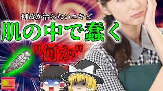 【2011年】顔の中で蠢く"ナニカ"ただのニキビだと思ったら…OLを襲った原因不明の症状 その意外な正体とは?【ゆっくり解説】