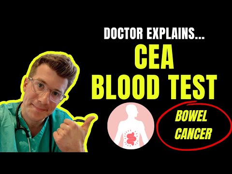 Carcinoembryonic Antigen (CEA) blood test explained | Use in BOWEL CANCER monitoring