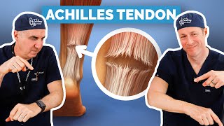 Achilles Tendon Rupture - Do You Need Surgery?