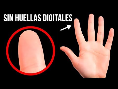 ¿Qué Pasaría Si No Tuvieras Huellas Digitales?