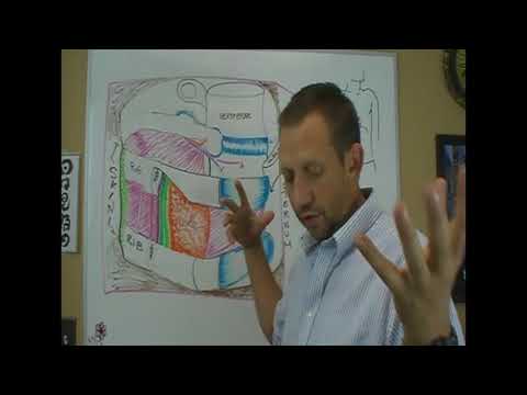 Costochondritis, explained with differential diagnosis