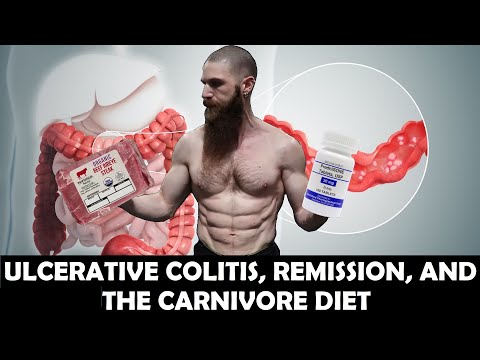 Carnivore Q&A: My ULCERATIVE COLITIS Story, REMISSION & the CARNIVORE DIET | Ulcerative Colitis Diet