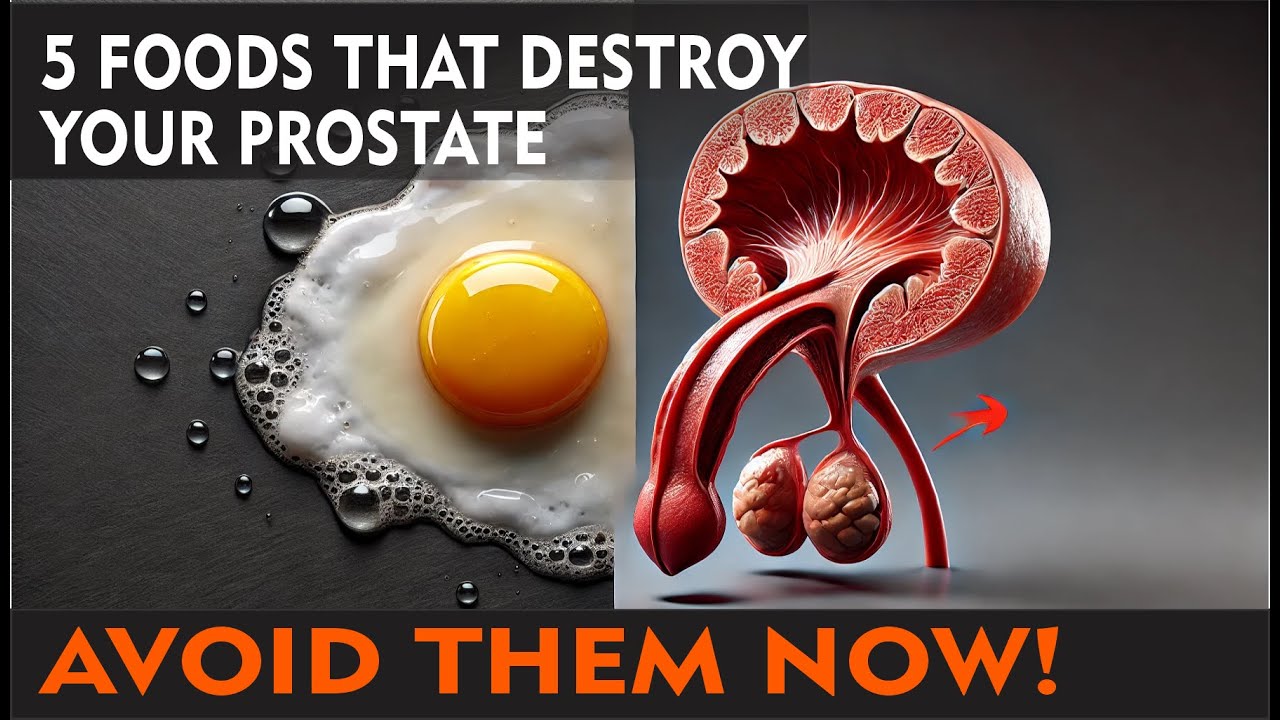 PROSTATE AT RISK  Foods you need to eliminate from your diet