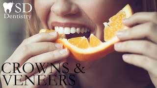 CROWNS & VENEERS