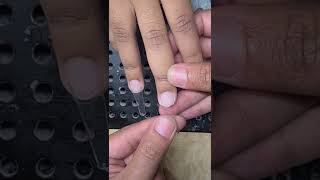 Crooked Finger? Here is the solution! #shorts #nails #solution