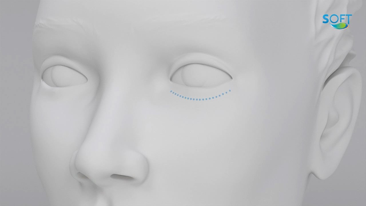 Juan Antonio Troyano Rivas-9