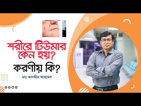 শরীরে টিউমার হলে করণীয় কি ? What to do during a tumor occurred in your body?