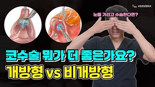 개방형 vs 비개방형 코수술❗ 뭐가 더 좋은가요?