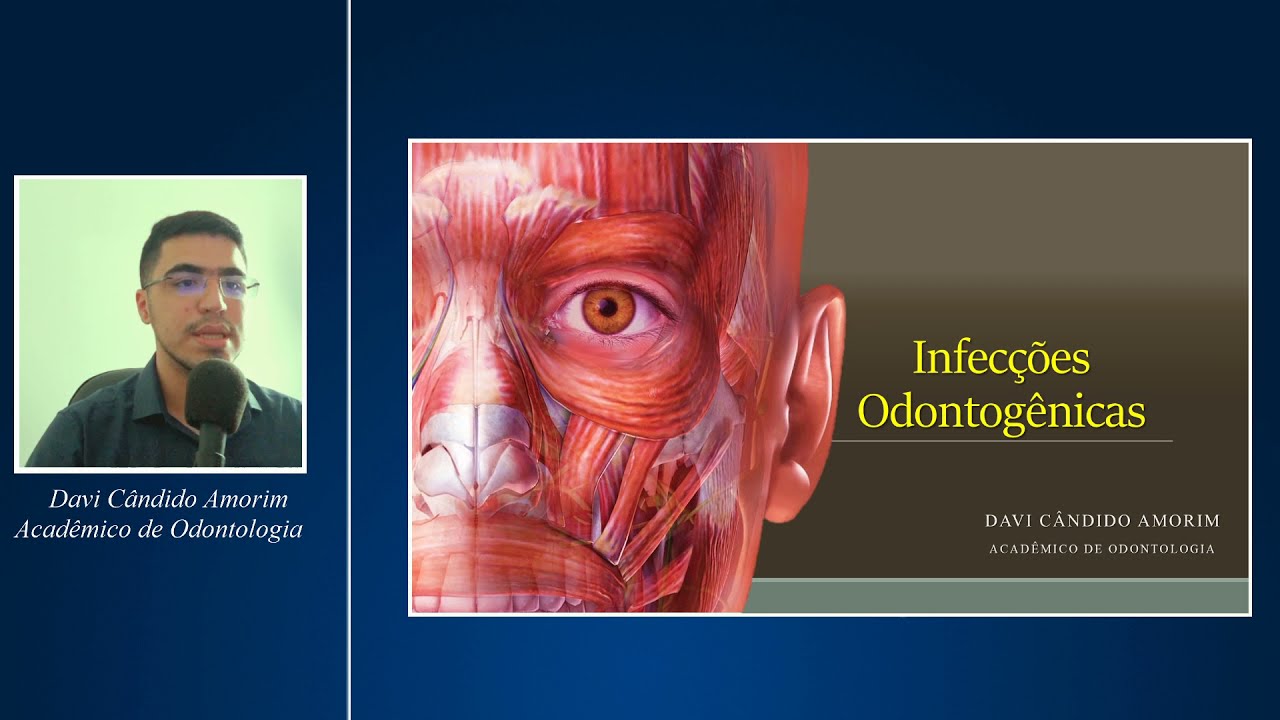 Infecções Odontogênicas Aula 1/2 - Etiologia, Microbiologia, Diagnóstico
