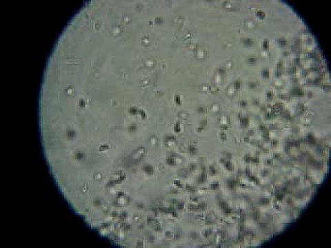 Watch Video on YouTube