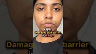 Repair Your Damaged Skin Barrier in JUST 5 Days! 🔥#skincare #glowup2025 #acnefree