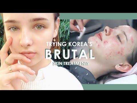 My First BRUTAL Korean Dermatology Experience 💉 #BANOBAGI Laser Treatments | Sissel