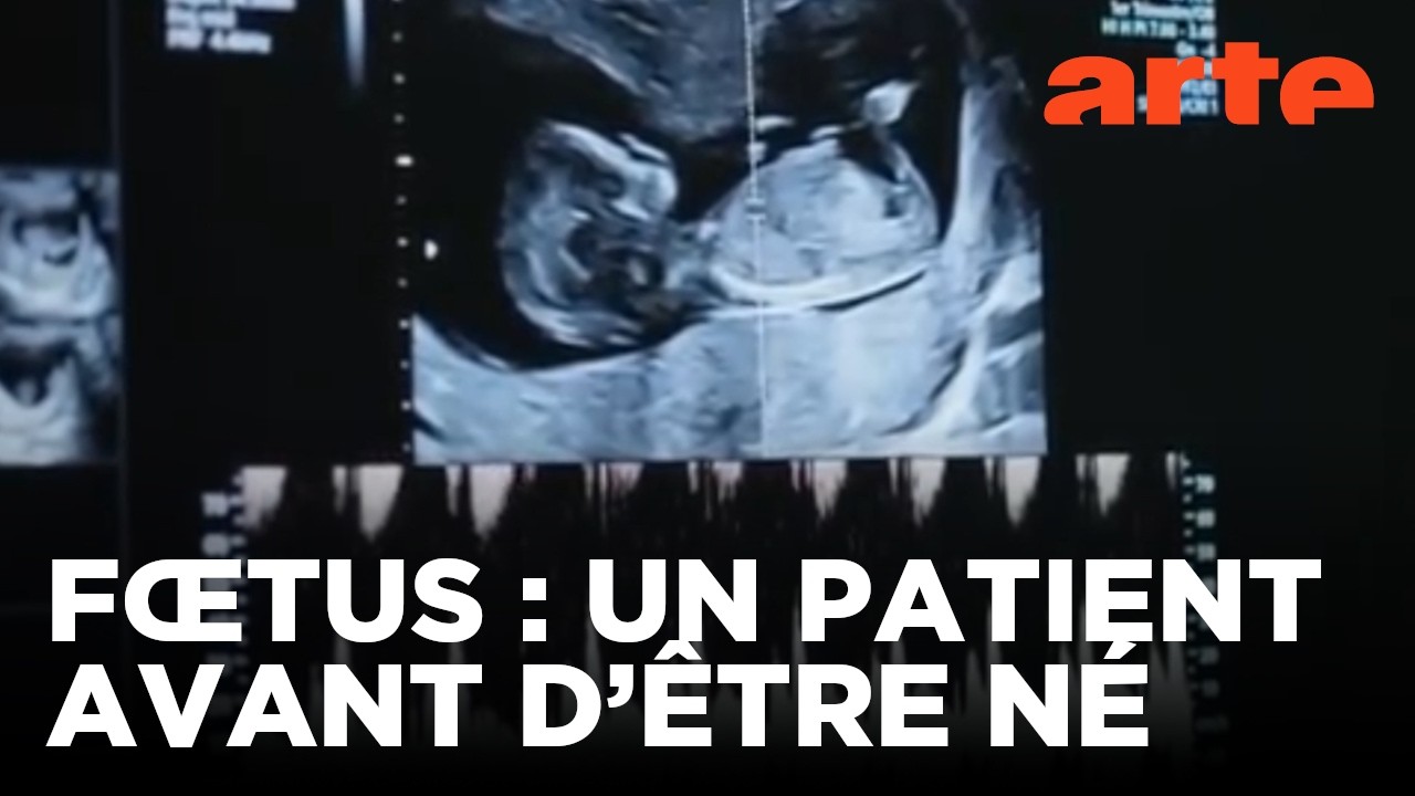 Le diagnostic prénatal, un progrès bouleversant | Documentaire | ARTE
