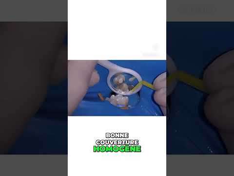 Coiffage pulpaire direct – Endodontie