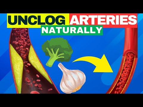 Top 10 Foods to Unclog Arteries Naturally And Avoid Heart Attack
