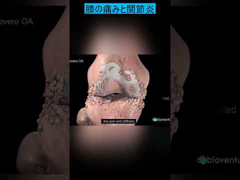 関節炎を患う恐竜