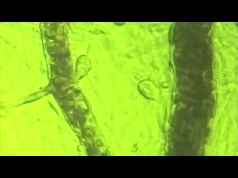 The BEMER Effect - microscopic demonstration of the effect on microcirculation _ EN...