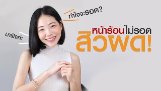 หน้าร้อนไม่รอดสิวผด จะทำยังไง มาฟังค่ะ!  | เคล็ดลับลดสิว EP.4 | Vikkaskincare เซรั่มลดสิว