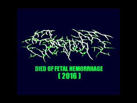 SKROTUM - DIED OF FETAL HEMORRHAGE (SINGLE 2016)