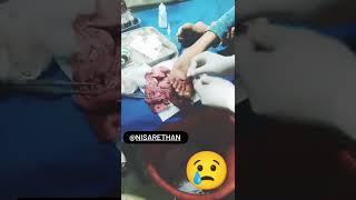 Sad video my friend accident sad status video real to YouTube