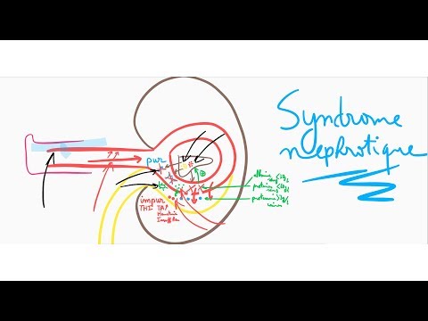 🔴 L'EXPLICATION LA PLUS CLAIRE DU SYNDROME NEPHROTIQUE  ! - DR ASTUCE