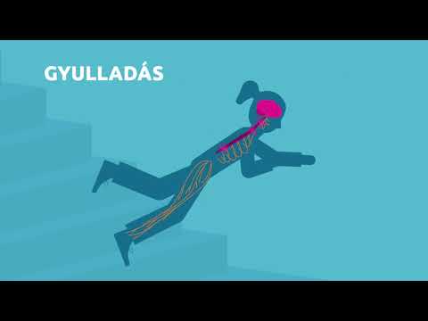 Hogyan hat a sclerosis multiplex az idegrendszerre?